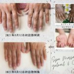 爪甲縦条 そうこうじゅうじょう 会津若松市にあるアラサーから始める プチごほうび型ネイルサロン